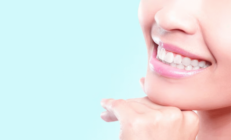 How to Prevent Cavities Naturally: A Complete Guide