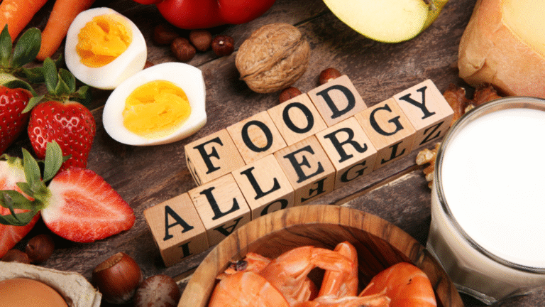 Food Allergy Symptoms and Management