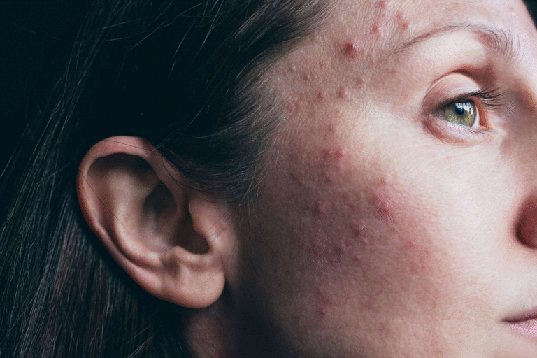 Understanding Hormonal Imbalance Symptoms: What Your Body Might Be Trying to Tell You