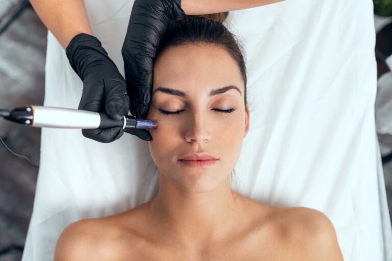 Addressing FAQs About Microneedling