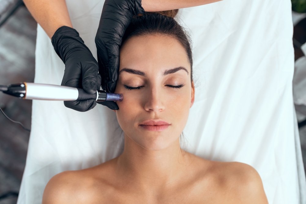 Addressing FAQs About Microneedling