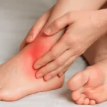 Effective Strategies for Sprained Ankle Treatment