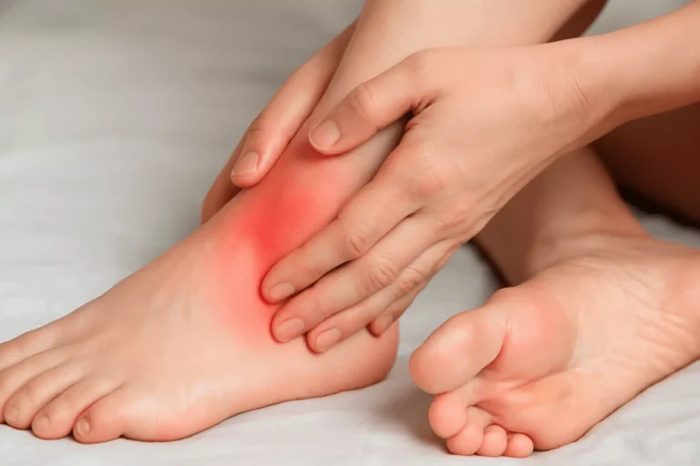 Effective Strategies for Sprained Ankle Treatment