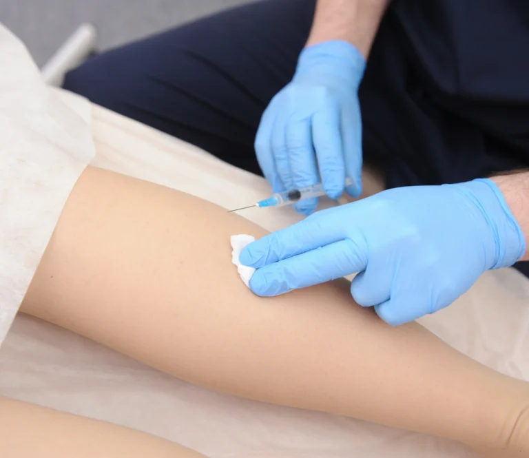 Efficacy and Benefits of Sclerotherapy