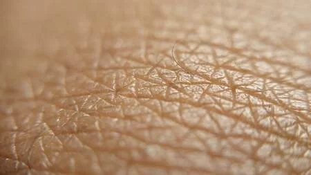 Exploring the Benefits of Mohs Micrographic Surgery for Skin Cancer Treatment