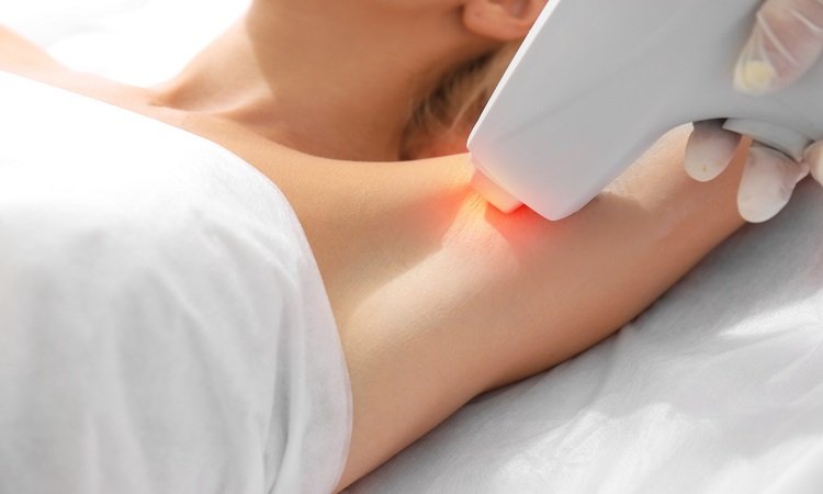How Laser Hair Removal Works