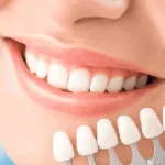 How a Cosmetic Dentist Can Transform Your Confidence