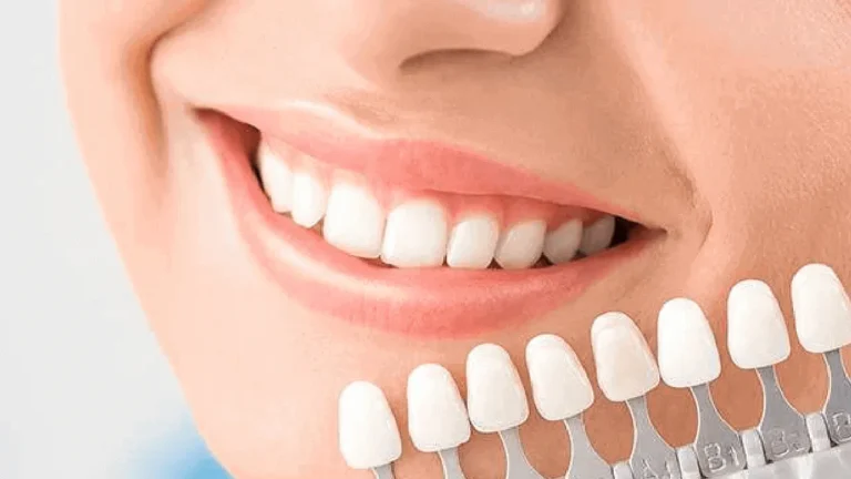 How a Cosmetic Dentist Can Transform Your Confidence