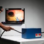 Innovative Techniques in Colonoscopy for Improved Patient Experience