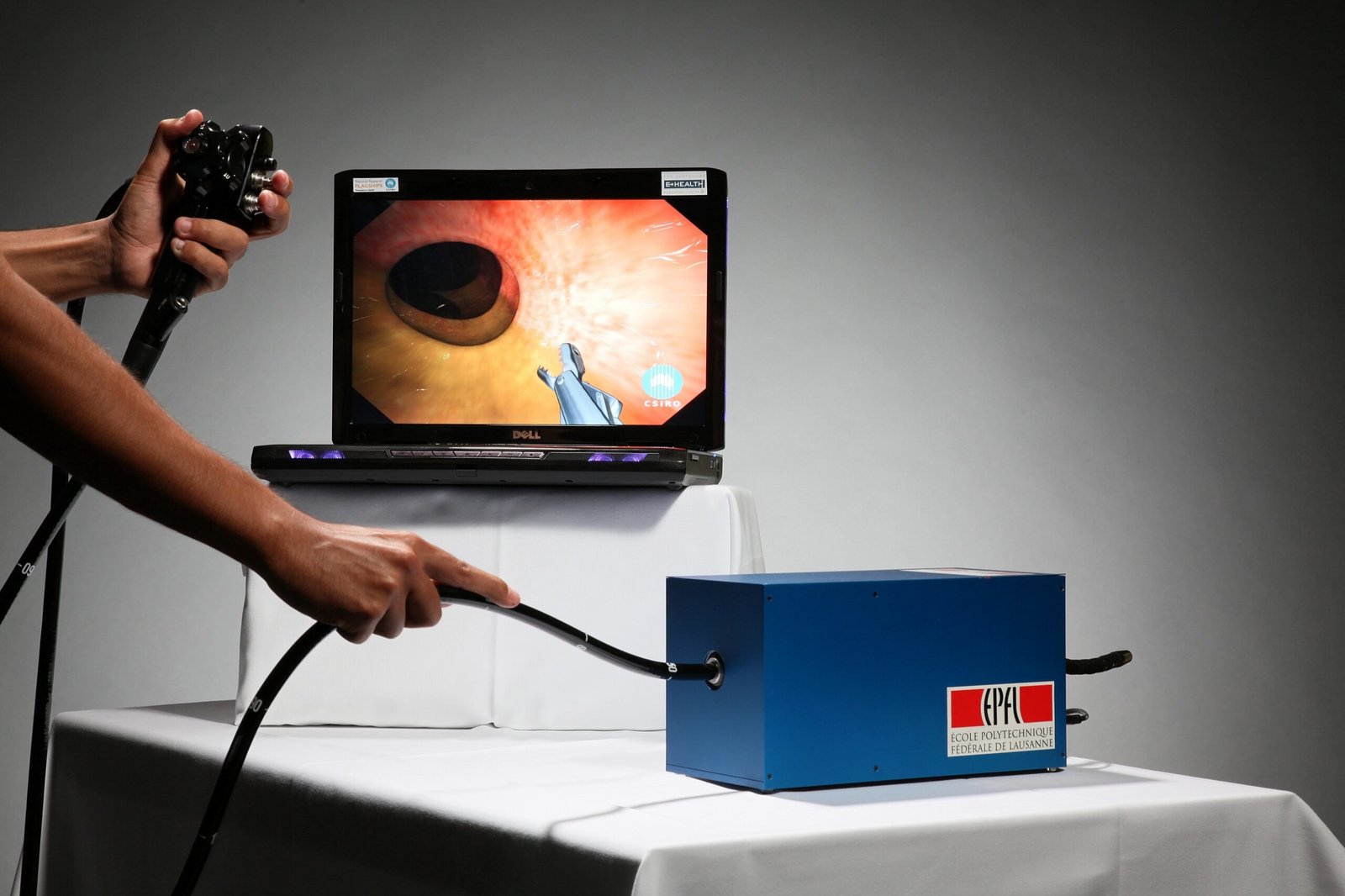 Innovative Techniques in Colonoscopy for Improved Patient Experience
