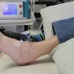 Innovative Treatments for Arthritis