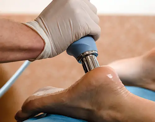 Innovative Treatments for Plantar Fasciitis