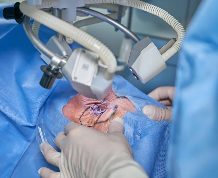 Is LASIK Surgery Right for Everyone?
