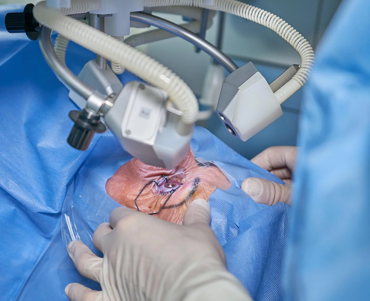 Is LASIK Surgery Right for Everyone?