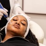 Microneedling vs. Other Skin Treatments