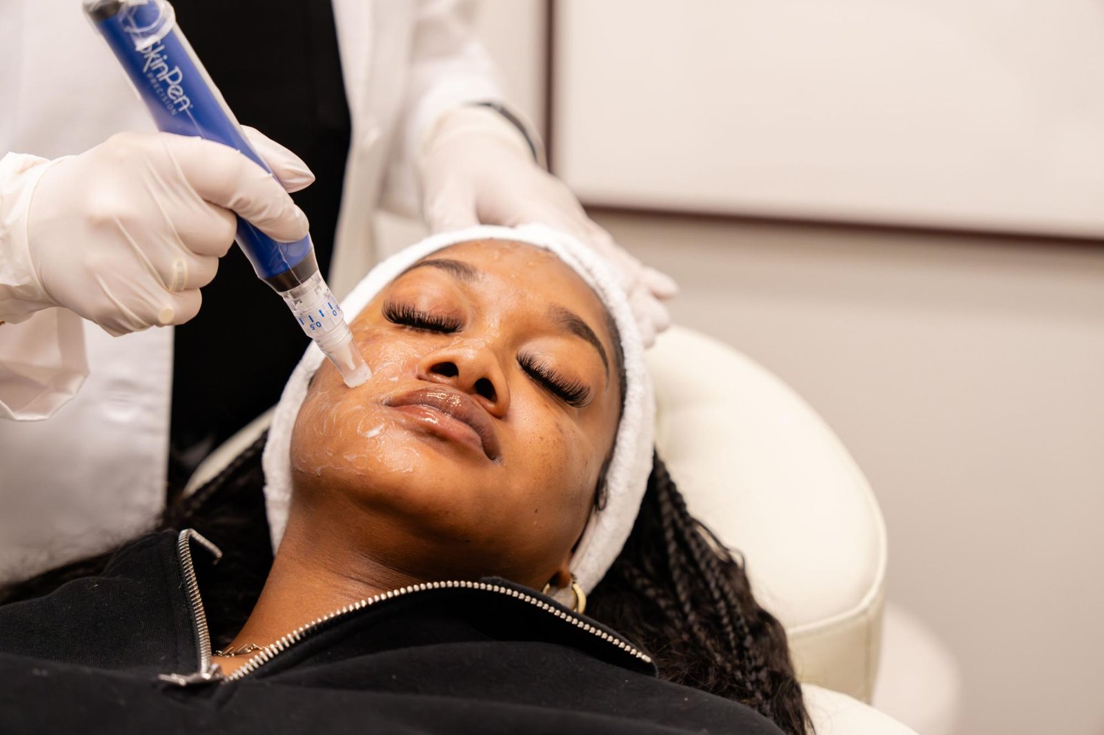 Microneedling vs. Other Skin Treatments