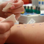 Questions to Ask Your Allergist During an Appointment