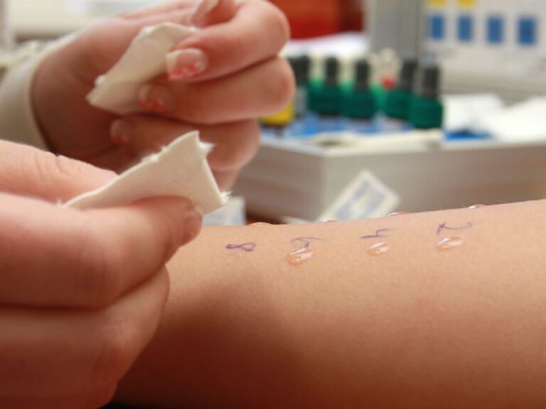 Questions to Ask Your Allergist During an Appointment