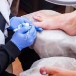 Steps for Ingrown Toenail Prevention