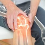 The Connection Between Arthritis and Joint Pain