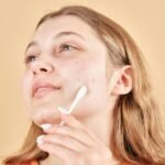 The Connection Between Hormones and Skin Conditions