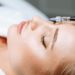 The Role of Dermal Fillers in Aesthetic Treatments