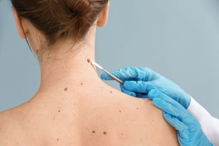 The Role of Dermatologists in Treating Skin Conditions