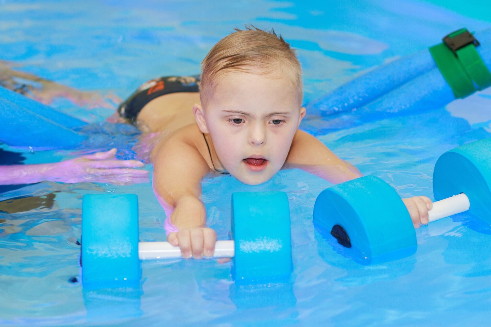 The Role of Pediatric Orthopaedics in Treating Sports Injuries