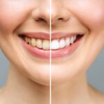 Transform Your Smile With Cosmetic Dentistry Techniques