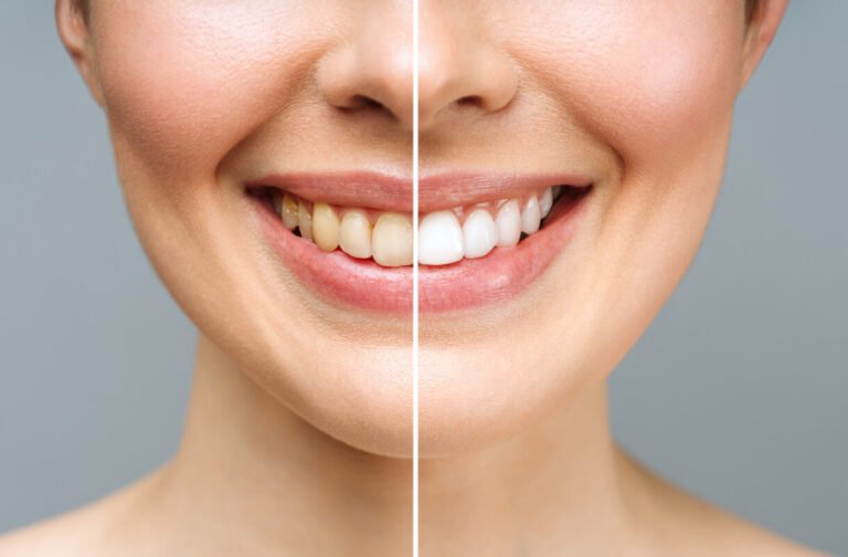 Transform Your Smile With Cosmetic Dentistry Techniques