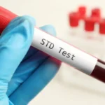 Understanding the Benefits of Regular STD Testing