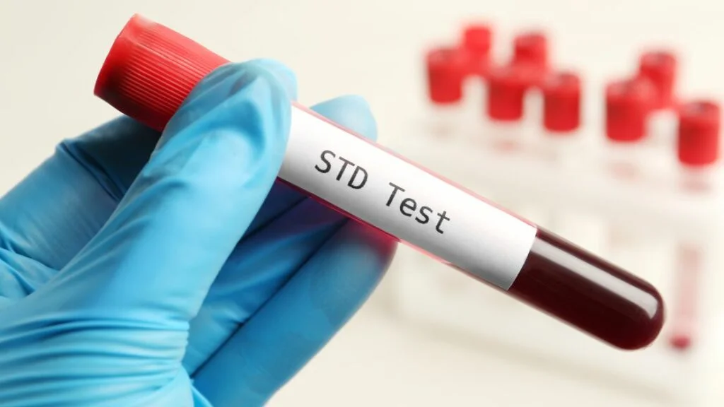 Understanding the Benefits of Regular STD Testing