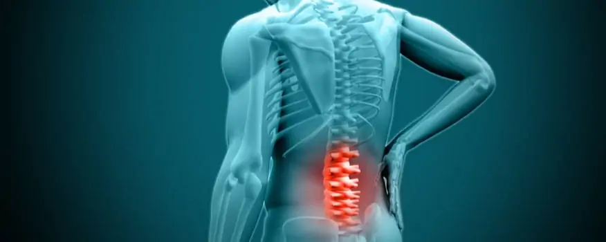 What Patients Should Know About Spine Surgery for Scoliosis