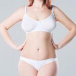 A Guide to Planning Your Mommy Makeover