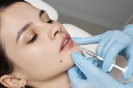 Aftercare Tips for Maximizing the Results of Dermal Fillers