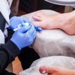 How Podiatrists Manage Sports Injuries Effectively