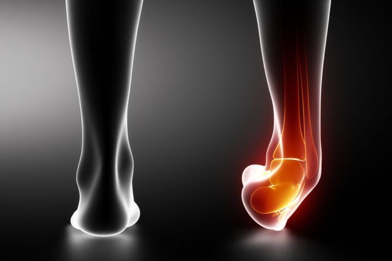 Recognizing the Symptoms of a Fractured Ankle