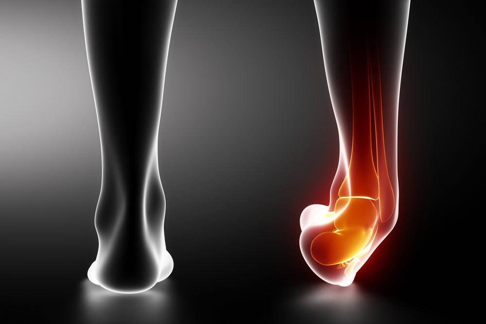 Recognizing the Symptoms of a Fractured Ankle