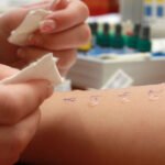 Signs You Need To Try Allergy Shots