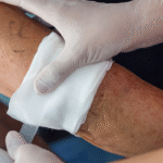 The Benefits of Wound Care in Managing Pain