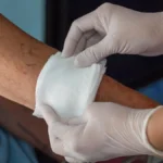 The Connection Between Proper Wound Care and Infection Prevention