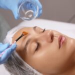 Understanding Post-care for Chemical Peels