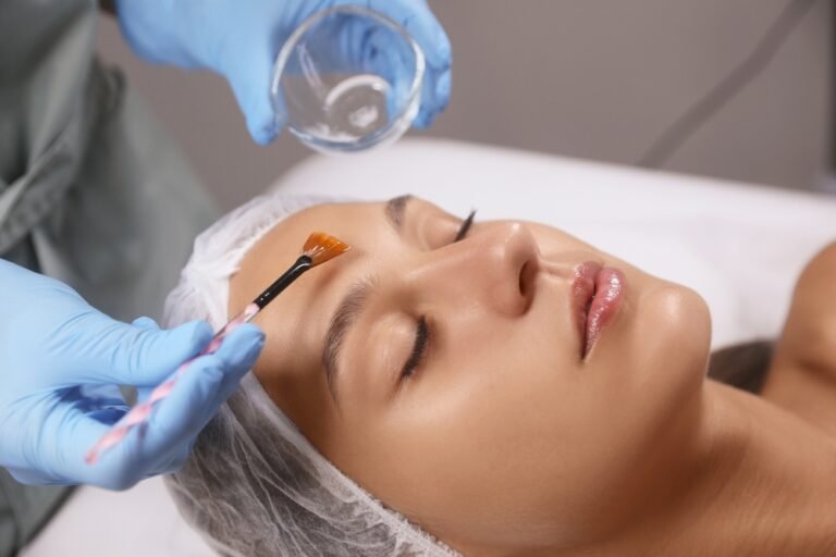 Understanding Post-care for Chemical Peels
