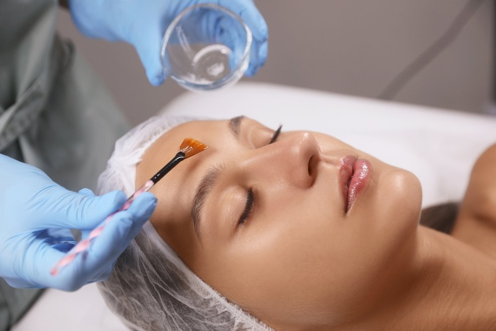 Understanding Post-care for Chemical Peels