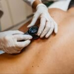 The Role of Mohs Surgery in Skin Cancer Treatment
