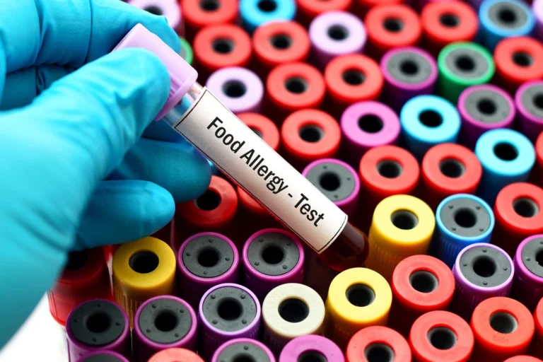Understanding the Different Types of Allergy Testing Available