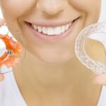 When Should You Replace Your Retainers