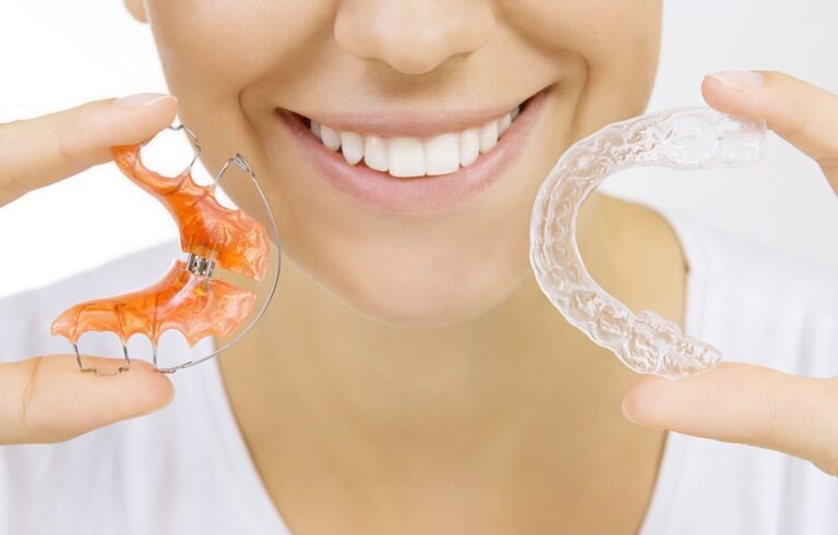When Should You Replace Your Retainers