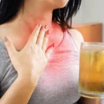 Dietary Tips to Reduce Acid Reflux Symptoms