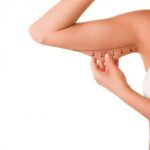 How To Know if Liposuction Is Right for You